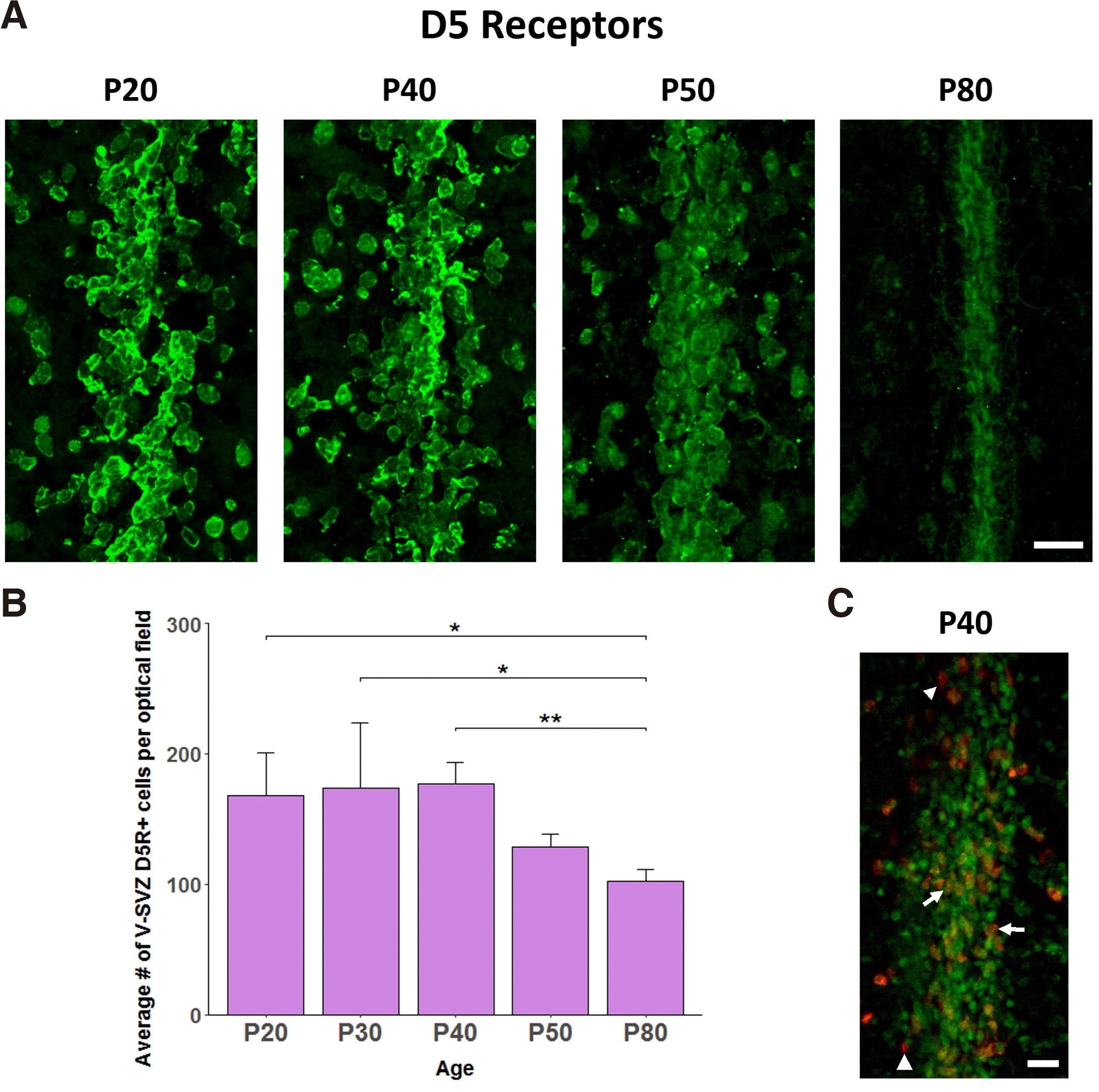 Expression of D5 dopamine receptors in the lateral ventricle walls ...