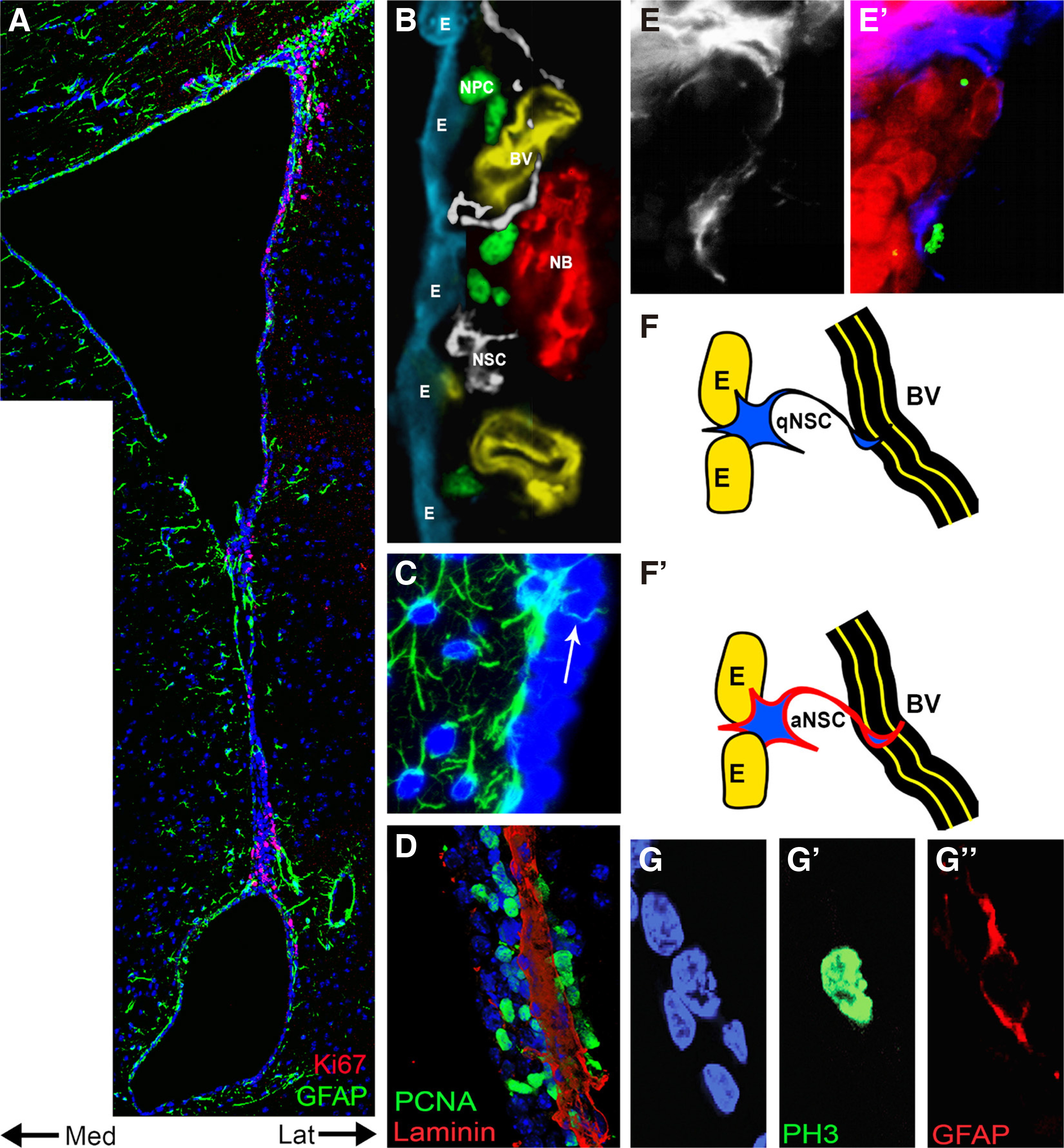 Heterogeneity of quiescent and active neural stem cells in the