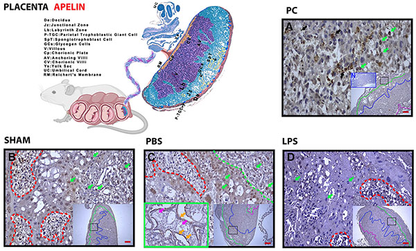 Evaluation of changes of apelin and apelin receptor (APJ) expression in ...